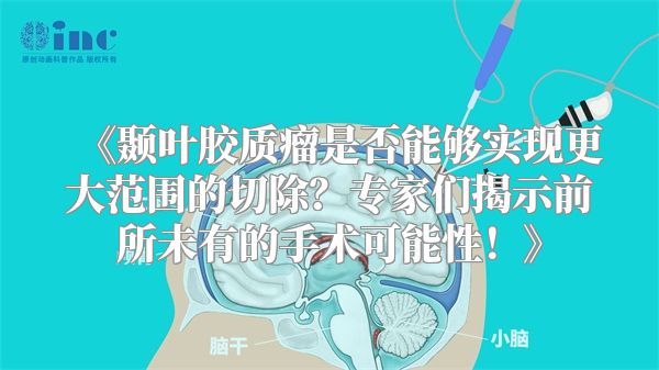 《颞叶胶质瘤是否能够实现更大范围的切除？专家们揭示前所未有的手术可能性！》