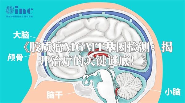 《胶质瘤MGMT基因检测：揭开治疗的关键谜底！》