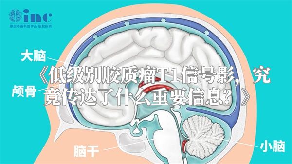 《低级别胶质瘤T1信号影，究竟传达了什么重要信息？》