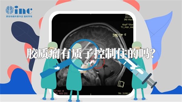 胶质瘤有质子控制住的吗？