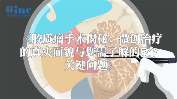 《胶质瘤手术揭秘：微创治疗的真实面貌与您需了解的5个关键问题》