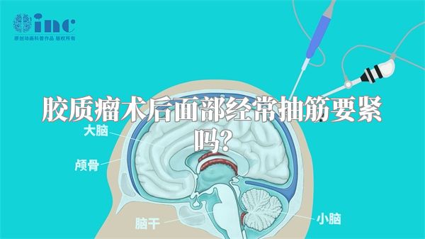 胶质瘤术后面部经常抽筋要紧吗？