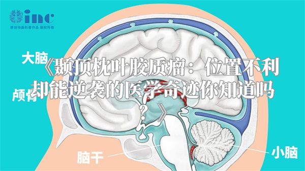《颞顶枕叶胶质瘤：位置不利却能逆袭的医学奇迹你知道吗？》