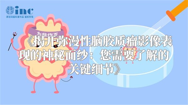 《揭开弥漫性脑胶质瘤影像表现的神秘面纱：您需要了解的关键细节》