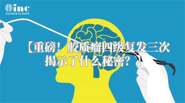 【重磅！胶质瘤四级复发三次揭示了什么秘密？】