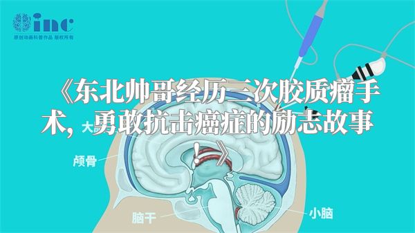 《东北帅哥经历三次胶质瘤手术，勇敢抗击癌症的励志故事！》