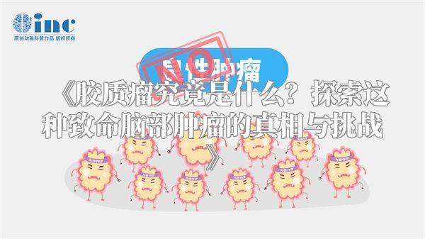 《胶质瘤究竟是什么？探索这种致命脑部肿瘤的真相与挑战》