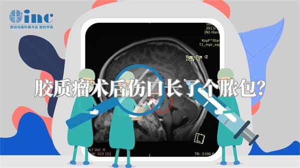 胶质瘤术后伤口长了个脓包？