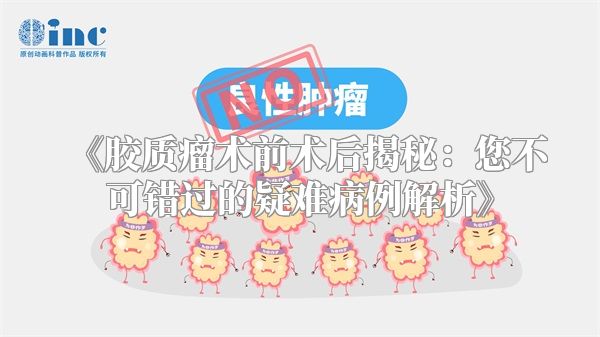 《胶质瘤术前术后揭秘：您不可错过的疑难病例解析》