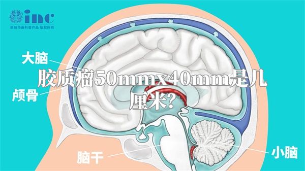 胶质瘤50mmx40mm是几厘米？