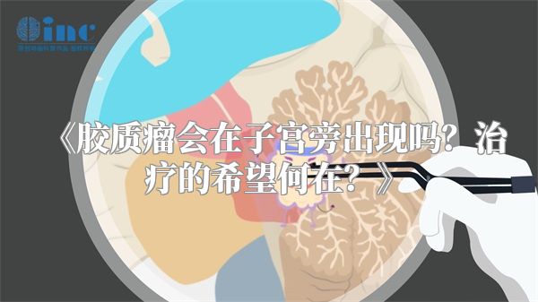 《胶质瘤会在子宫旁出现吗？治疗的希望何在？》