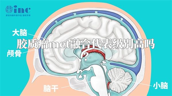 胶质瘤met融合代表级别高吗？