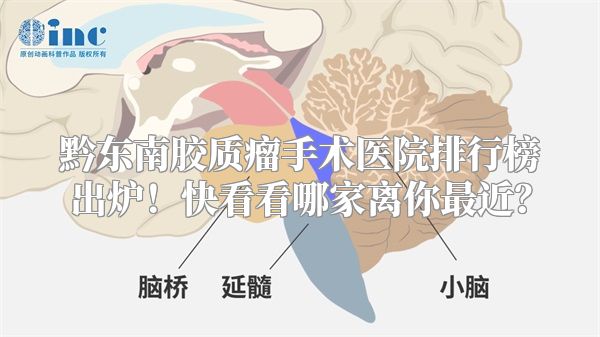 黔东南胶质瘤手术医院排行榜出炉！快看看哪家离你最近？