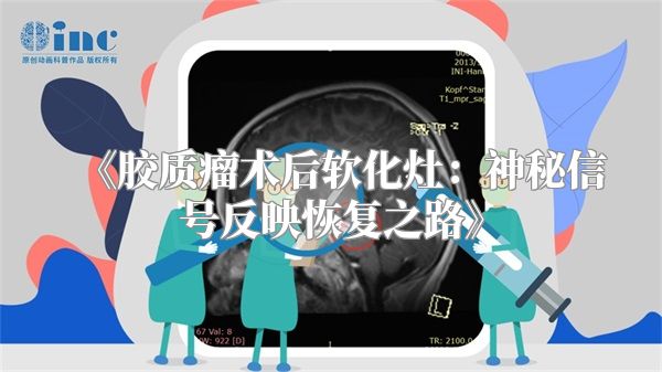 胶质瘤术后软化灶：神秘信号反映恢复之路
