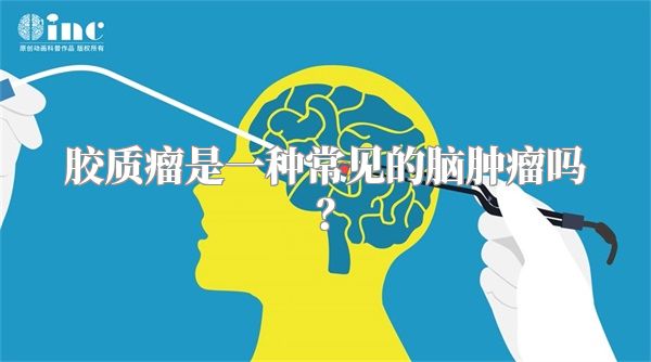 胶质瘤是一种常见的脑肿瘤吗？