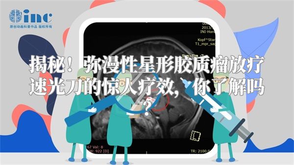 揭秘！弥漫性星形胶质瘤放疗速光刀的惊人疗效，你了解吗？