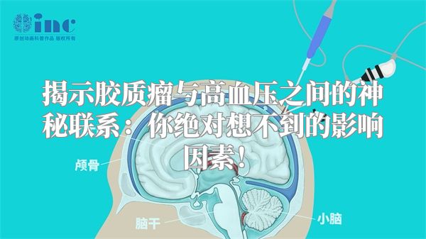 揭示胶质瘤与高血压之间的神秘联系：你绝对想不到的影响因素！
