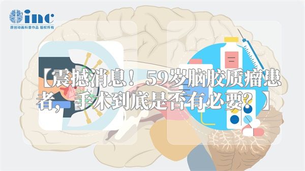 【震撼消息！59岁脑胶质瘤患者，手术到底是否有必要？】