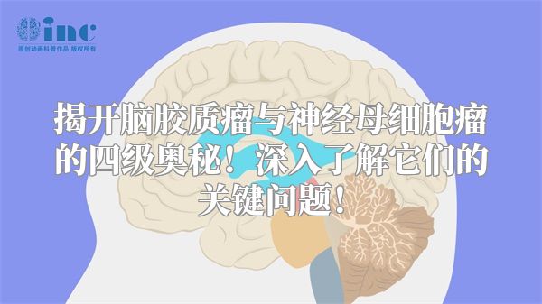 揭开脑胶质瘤与神经母细胞瘤的四级奥秘！深入了解它们的关键问题！