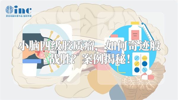 小脑四级胶质瘤，如何奇迹般战胜？案例揭秘！