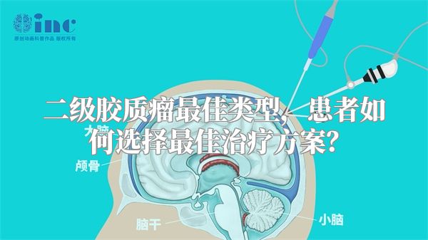 二级胶质瘤最佳类型，患者如何选择最佳治疗方案？