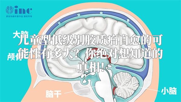 儿童型低级别胶质瘤自愈的可能性有多大？你绝对想知道的真相！