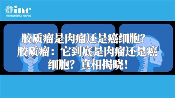 胶质瘤是肉瘤还是癌细胞？ 胶质瘤：它到底是肉瘤还是癌细胞？真相揭晓！