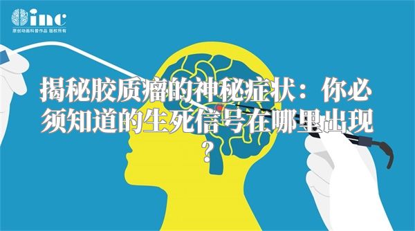揭秘胶质瘤的神秘症状：你必须知道的生死信号在哪里出现？
