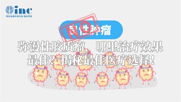弥漫性胶质瘤，哪里治疗效果最佳？揭秘最佳医疗选择！