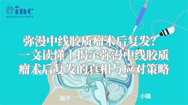 弥漫中线胶质瘤术后复发？ 一文读懂丨揭示弥漫中线胶质瘤术后复发的真相与应对策略