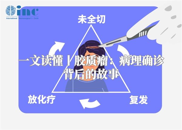一文读懂丨胶质瘤：病理确诊背后的故事