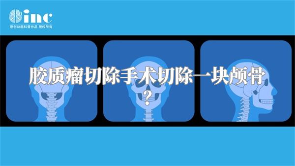 胶质瘤切除手术切除一块颅骨？