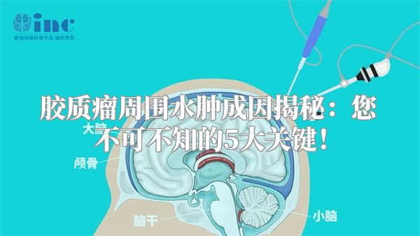 胶质瘤周围水肿成因揭秘：您不可不知的5大关键！