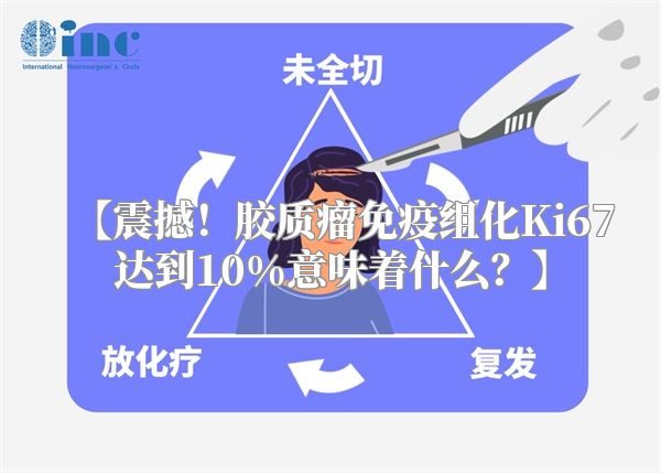 【震撼！胶质瘤免疫组化Ki67达到10%意味着什么？】
