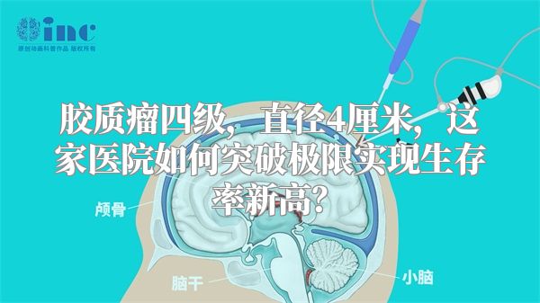 胶质瘤四级，直径4厘米，这家医院如何突破极限实现生存率新高？