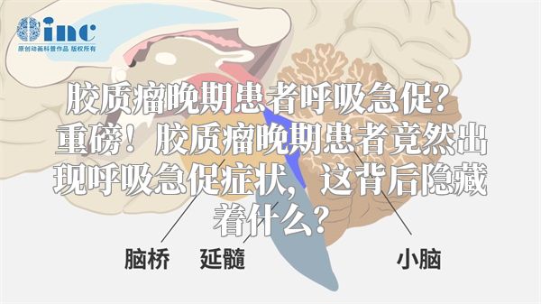 胶质瘤晚期患者呼吸急促？ 重磅！胶质瘤晚期患者竟然出现呼吸急促症状，这背后隐藏着什么？