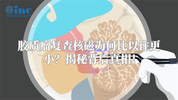 胶质瘤复查核磁为何比以往更小？揭秘背后真相！