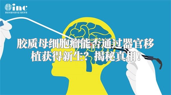 胶质母细胞瘤能否通过器官移植获得新生？揭秘真相！