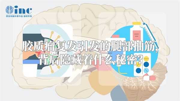 胶质瘤复发引发的腿部抽筋，背后隐藏着什么秘密？