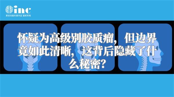 怀疑为高级别胶质瘤，但边界竟如此清晰，这背后隐藏了什么秘密？