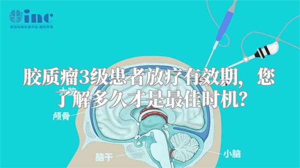 胶质瘤3级患者放疗有效期，您了解多久才是最佳时机？