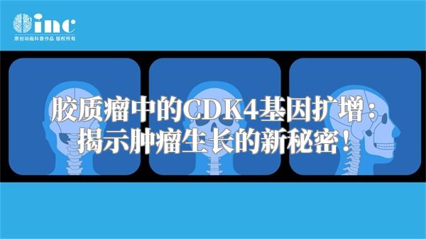 胶质瘤中的CDK4基因扩增：揭示肿瘤生长的新秘密！