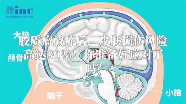 胶质瘤放疗后，皮肤损伤风险高达30%！你准备好应对了吗？