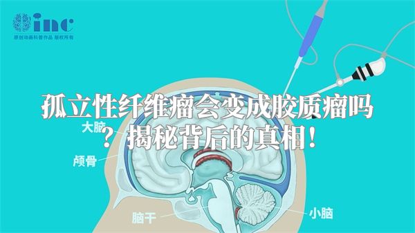 孤立性纤维瘤会变成胶质瘤吗？揭秘背后的真相！