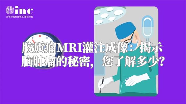 胶质瘤MRI灌注成像：揭示脑肿瘤的秘密，您了解多少？