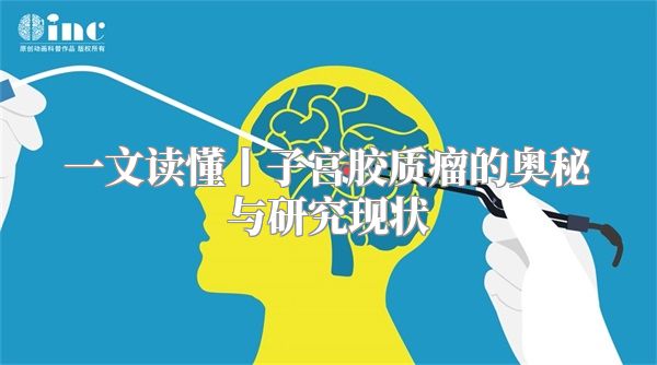 一文读懂丨子宫胶质瘤的奥秘与研究现状