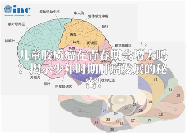 儿童胶质瘤在青春期会增大吗？揭示少年时期肿瘤发展的秘密！