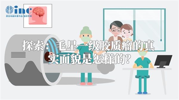 探索：毛星一级胶质瘤的真实面貌是怎样的？