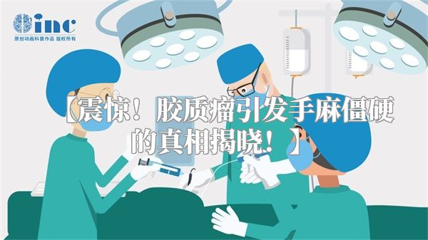 【震惊！胶质瘤引发手麻僵硬的真相揭晓！】