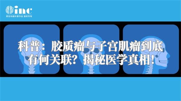 科普：胶质瘤与子宫肌瘤到底有何关联？揭秘医学真相！